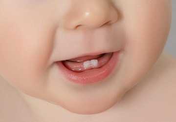 What to Do When Your Baby is Teething?